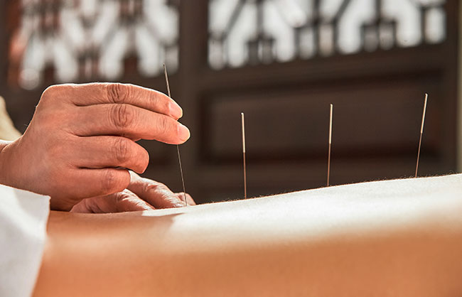 Acupuncture in Raleigh, North Carolina