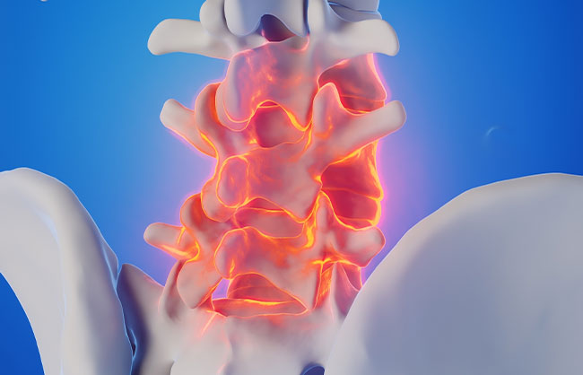 low back pain in Raleigh, North Carolina