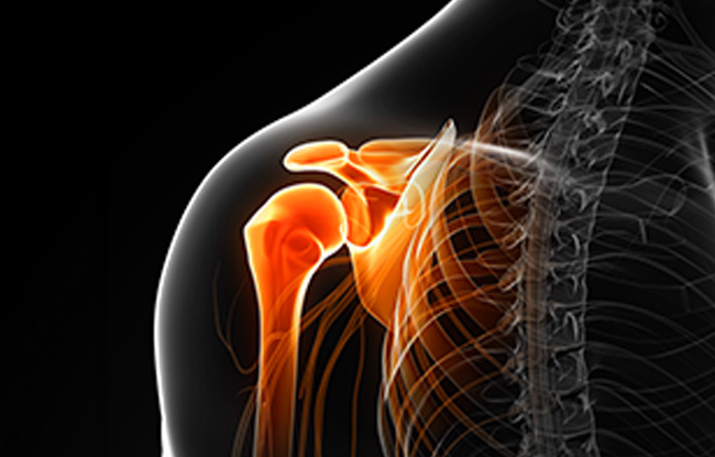 Patient undergoing Rotator Cuff Injuries treatment at Advanced Pain Consultants, PA