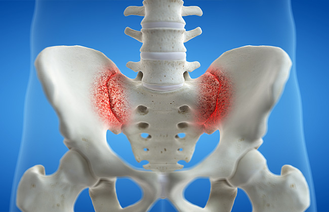 Sacroiliac Joint Dysfunction in Raleigh, North Carolina